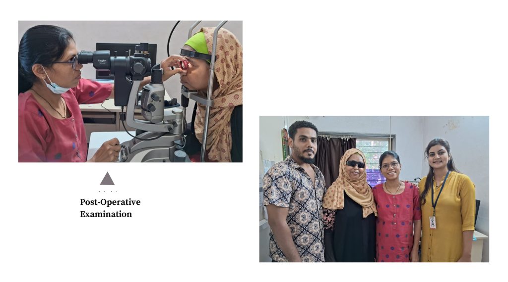 Traumatic Case of LE from Kenya operated for – Cataract Extraction with SOS IOL (Iris Claw) with (Dr. Archana Chaudhari)